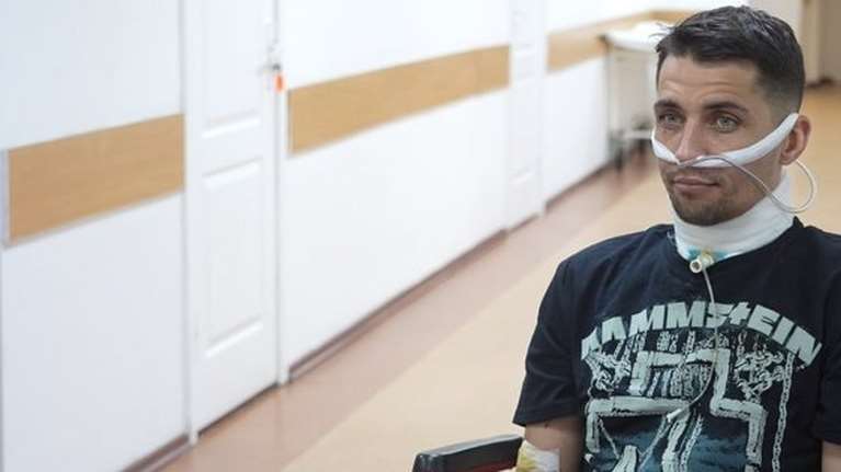 Η απίστευτη ιστορία του Ουκρανού στρατιώτη Βλάντισλαβ: Επιβίωσε με κομμένο λαιμό για πέντε μέρες μετά από ρωσικά βασανιστήρια