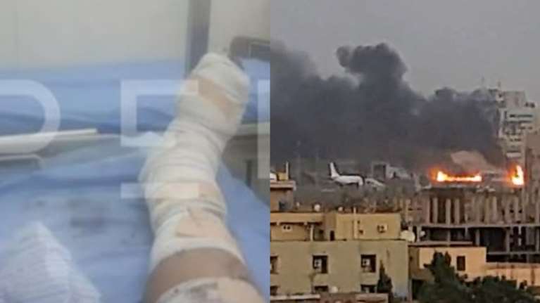 Σουδάν: Φωτογραφία ντοκουμέντο του Έλληνα τραυματία μέσα από το νοσοκομείο - Δεν υπάρχουν γιατροί