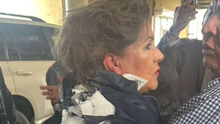 Εκρηξη στο Κογκρέσο της Ονδούρας: Σοβαρά τραυματισμένη βουλευτής -Ανησυχία για βλάβη στην ακοή [βίντεο]