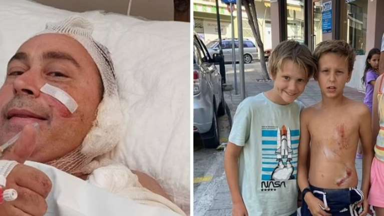 Κόρινθος: Αγέλη 15 σκύλων επιτέθηκε σε οικογένεια Βρετανών - &#39;&#39;Με πέταξαν στο έδαφος κι άρχισαν να με δαγκώνουν&#39;&#39; [εικόνες]