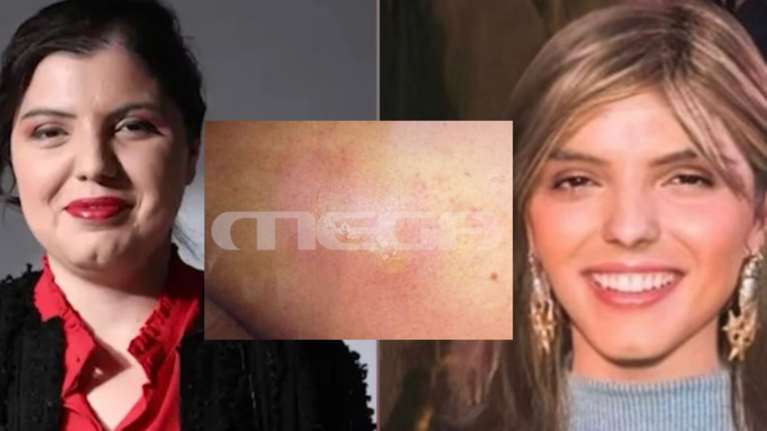 Μαρίσσα Λαιμού: Τα μηνύματα σε φίλη της μέσα από το νοσοκομείο - &quot;Είμαι χάλια, κανείς δεν με έχει τσεκάρει&quot;