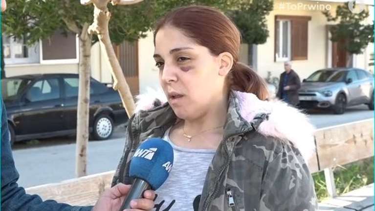 Συγκλονίζει η 32χρονη στο Αργος: "Με βίασε, με χτύπησε και απείλησε να κάψει ζωντανά τα παιδιά μας" [βίντεο]