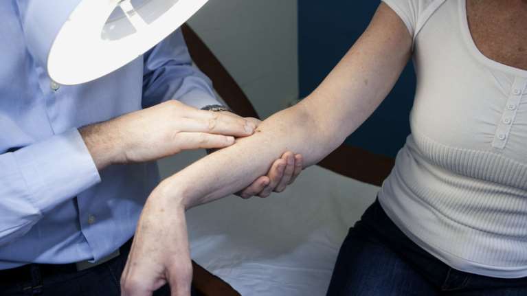 Καμπανάκι ειδικών για τον καρκίνο του δέρματος: Τα ύποπτα σημάδια και τι πρέπει να προσέχουμε