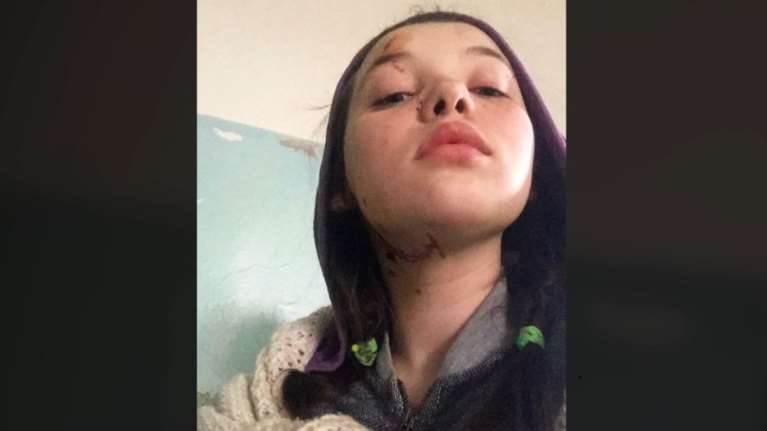 Συγκλονίζει η 12χρονη από τη Μαριούπολη: Πώς γλίτωσε από τους Ρώσους και το ορφανοτροφείο μετά τον φόνο του πατέρα της