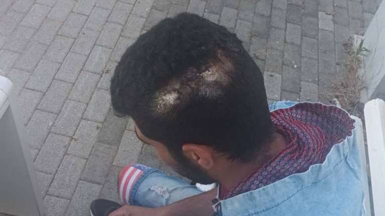 Κρήτη: Εικόνες σοκ από τον ξυλοδαρμό εργαζόμενου με αλυσίδα, επειδή ζήτησε από τον εργοδότη τα δεδουλευμένα του