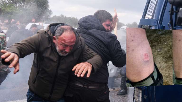 Νέο… πεδίο μάχης: Οι αγρότες καταγγέλλουν ότι δέχθηκαν πλαστικές σφαίρες, για ψευδή δημοσιεύματα κάνει λόγο η ΕΛ.ΑΣ.