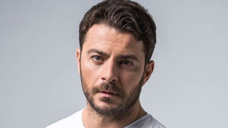 Ο Γιώργος Αγγελόπουλος έκανε εμφύτευση μαλλιών - Βήμα - βήμα η διαδικασία που ακολούθησε