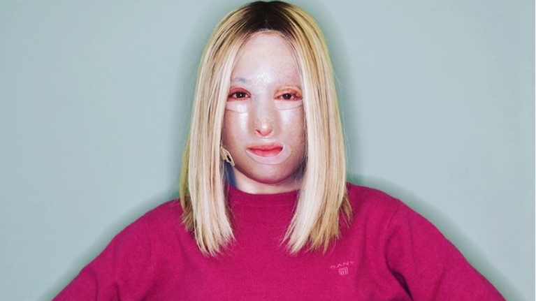 Πλεύρης για την υπόθεση Παλιοσπύρου: Θα αποζημιώνονται οι εγκαυματίες από εγκληματικές ενέργειες