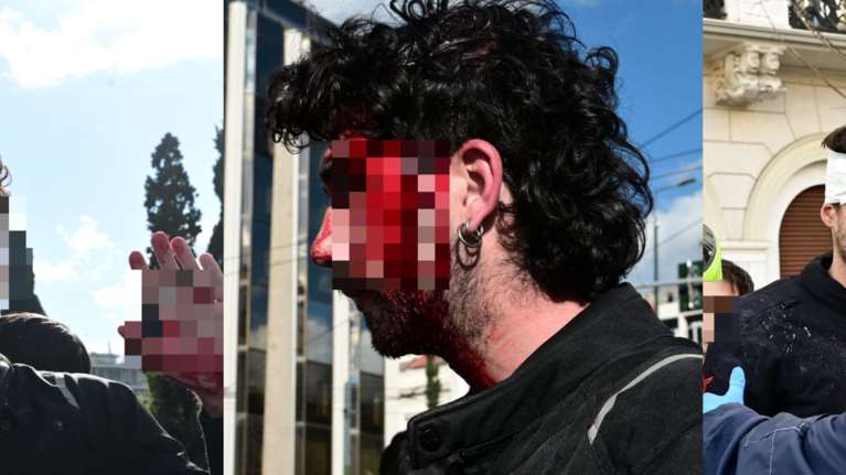 Σοβαρά επεισόδια στο Σύνταγμα: Τραυματίστηκαν εννιά φοιτητές, μεταφέρθηκαν στο νοσοκομείο &quot;Γεννηματάς&quot; [Σκληρές εικόνες]
