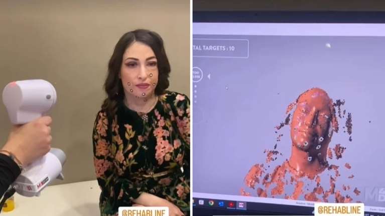 Ιωάννα Παλιοσπύρου: Αποκαλύπτει πώς κατασκευάζονται οι ειδικές μάσκες που φοράει για τα εγκαύματα [εικόνες]