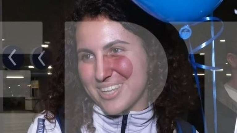 Παγκόσμια διάκριση για την cheerleader κόρη του Νίκου Γκάλη [βίντεο]