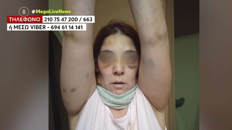 Άργος: &quot;Έτρωγα ξύλο για πέντε χρόνια, μου έλεγε ότι θα με σκοτώσει&quot; – Συγκλονίζει η 32χρονη που την κακοποιούσε ο σύζυγός της