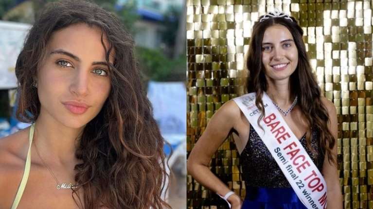 Βασίλισσα της φυσικής ομορφιάς: Για πρώτη φορά στην ιστορία των καλλιστείων, διαγωνιζόμενη διεκδικεί το &quot;στέμμα&quot; χωρίς μακιγιάζ