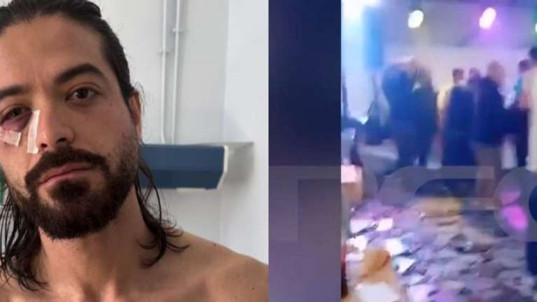 Άρης Μουγκοπέτρος: Βίντεο ντοκουμέντο μετά τον τραυματισμό του - &quot;Γνωρίζει ποιος του έδωσε την κροτίδα, του δίνει χρόνο να πάει στις Αρχές μόνος του&quot;