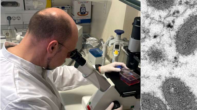 Διαστάσεις επιδημίας λαμβάνει η ευλογιά των πιθήκων στην Ευρώπη: Τα χειρότερα ίσως έρθουν το καλοκαίρι