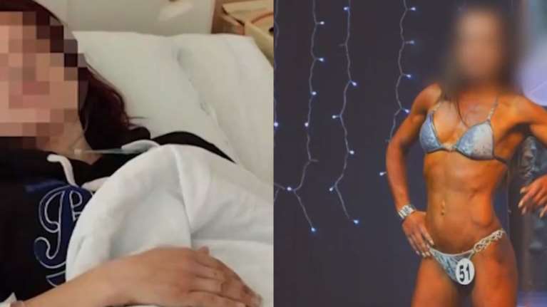 Σπάρτη: Άγριος ξυλοδαρμός πρώην bodybuilder από τον σύζυγό της - "Με χτυπούσε με μένος, προσπάθησε να με πνίξει"