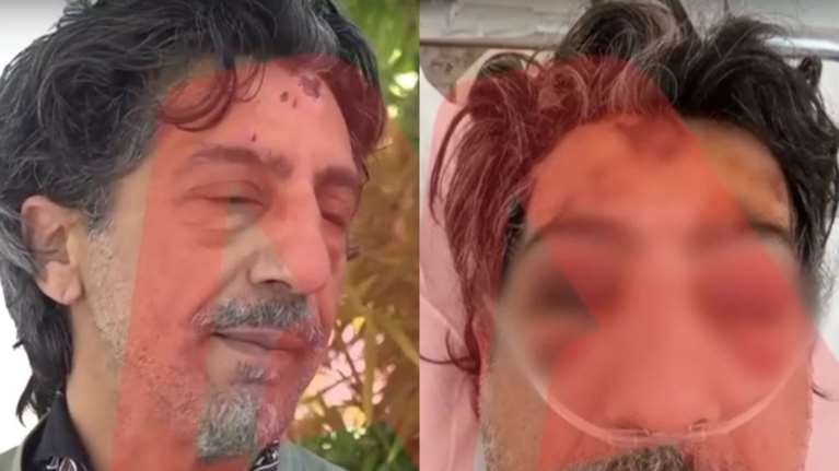 Άνω Λιόσια: Άγρια επίθεση σε οδηγό λεωφορείου - Του πέταξαν τσιμεντόλιθο στο κεφάλι [βίντεο]