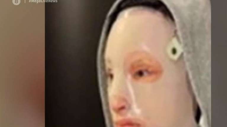 Επίθεση με βιτριόλι: Τι είναι η ειδική μάσκα και γιατί τη φορά σχεδόν όλη τη μέρα η Ιωάννα [Βίντεο]