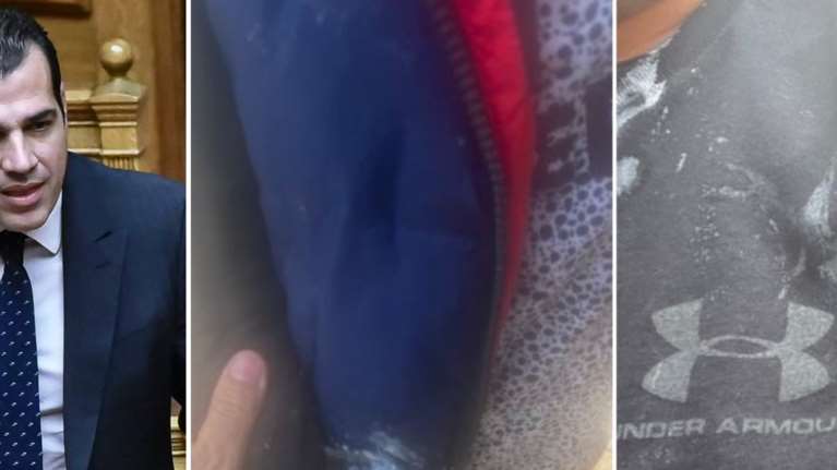 Στα επείγοντα στο Λαϊκό Νοσοκομείο ο Θάνος Πλεύρης μετά την επίθεση με γιαούρτι: Τραυματίστηκε στο μάτι