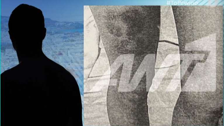 Καθηγήτρια κατήγγειλε 40χρονο επιχειρηματία της Μυκόνου ότι τη νάρκωσε και τη βίασε [Βίντεο]