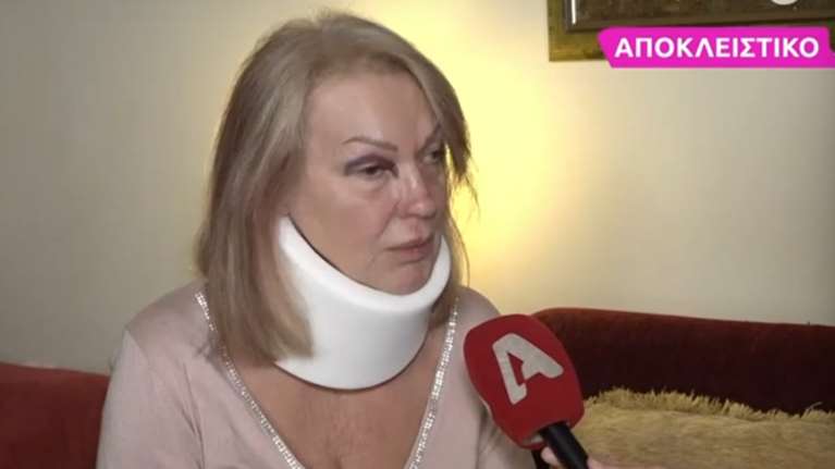 Ατύχημα στην Ερμού για την ηθοποιό Τζόυς Μιχαηλίδου: &quot;Θα κάνω μήνυση και αγωγή στον Δήμο Αθηναίων&quot;