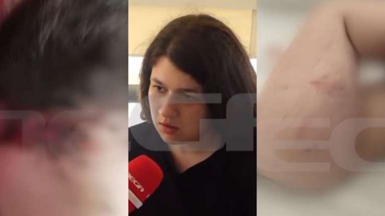 Κρήτη: Σοκάρουν τα σημάδια κακοποίησης της 3χρονης - &quot;Δεν πήρα χαμπάρι&quot; λέει η μητέρα της για τον σύντροφό της [Βίντεο]