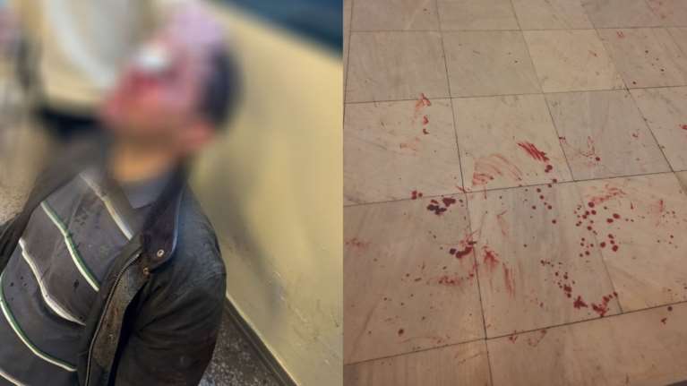 Επεισόδια στη Νομική Αθηνών: &quot;Τελειώσατε τώρα&quot; φώναζαν οι κουκουλοφόροι - &quot;Δεν έχω δει ξανά τόση βία στο πανεπιστήμιο&quot; [εικόνες - βίντεο]