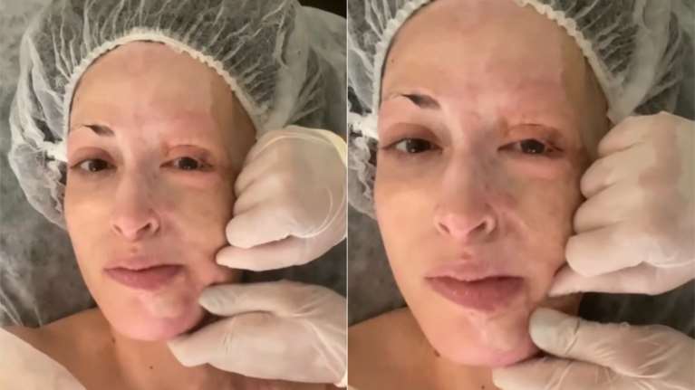Ιωάννα Παλιοσπύρου: Χωρίς ίχνος μακιγιάζ μας δείχνει το μασάζ που κάνει στο πρόσωπο μετά τις επεμβάσεις