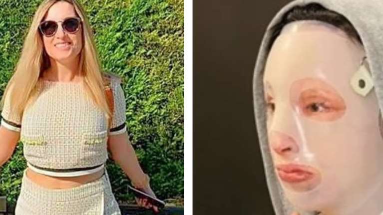 Ιωάννα Παλιοσπύρου: Η πρώτη συνέντευξη μετά την επίθεση με το βιτριόλι- "Η όψη μου με τρομάζει"