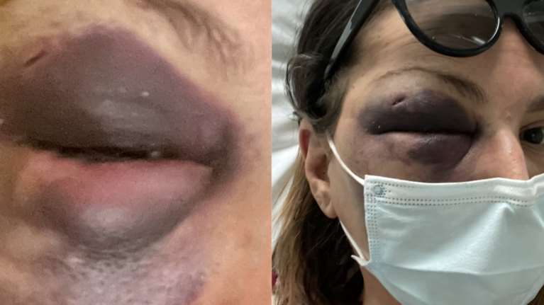 Στεφανία Τζαφέρη: Μυστήριο με την κακοποίηση της food blogger από την Κρήτη - Νέες σοκαριστικές εικόνες