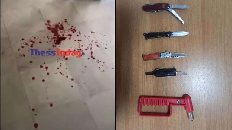 ΕΠΑΛ Σταυρούπολης: Εικόνες σοκ με μαχαίρια και σιδερογροθιές των κουκουλοφόρων χρυσαυγιτών - Αίματα στους διαδρόμους του σχολείου