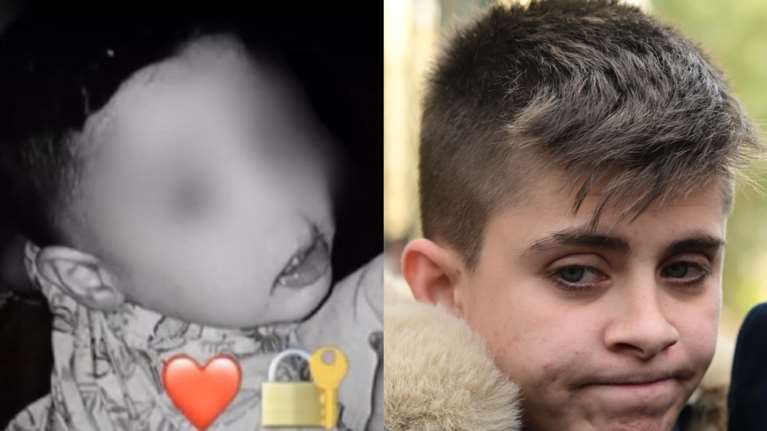 Αμαλιάδα: Τι είναι η πνευμονορραγία που φέρεται να έχει βρεθεί στον Παναγιωτάκη και &quot;δείχνει&quot; ασφυξία [βίντεο]