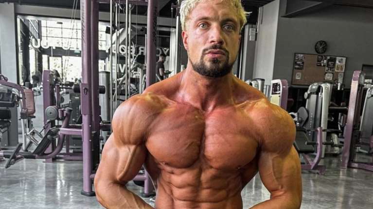 Νεκρός από ανεύρυσμα σε ηλικία 30 ετών διάσημος influencer μπόντι μπίλντερ