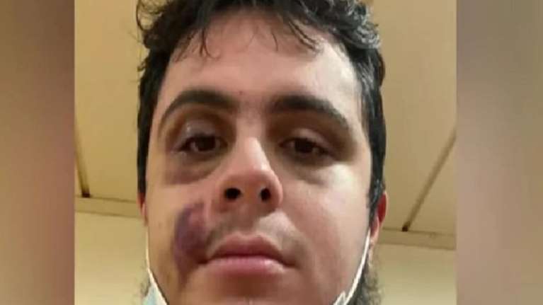 Νέα καταγγελία για οπαδική βία: Χτύπησαν άγρια 23χρονο στη μέση του δρόμου - &#39;&#39;Αυτό που με χωρίζει από τον Άλκη, είναι η τύχη&#39;&#39;