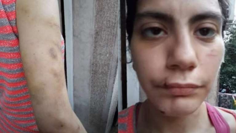 Γειτόνισσα Φαίης Μπακογιώργου: Τελευταία φορά την είδα με αίματα και σημάδια - Δεν μπορούσε να μιλήσει