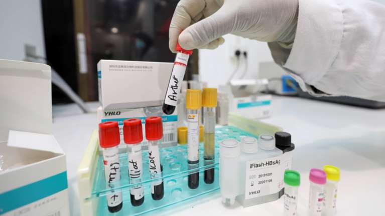 Κορονοϊός: Ανακαλύφθηκε πρωτεΐνη που μπλοκάρει τη λοίμωξη - Κολλά σαν... αυτοκόλλητη ταινία στον ιό