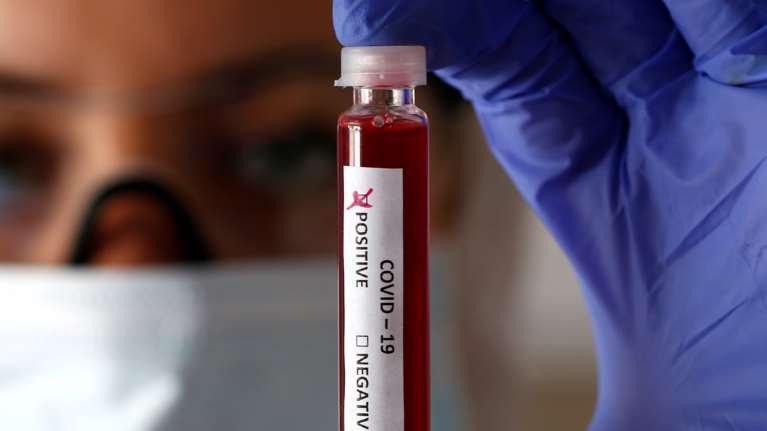 Δεύτερο &quot;κύμα&quot; της πανδημίας σαρώνει τις ΗΠΑ - 48.000 νέα κρούσματα το τελευταίο 24ωρο