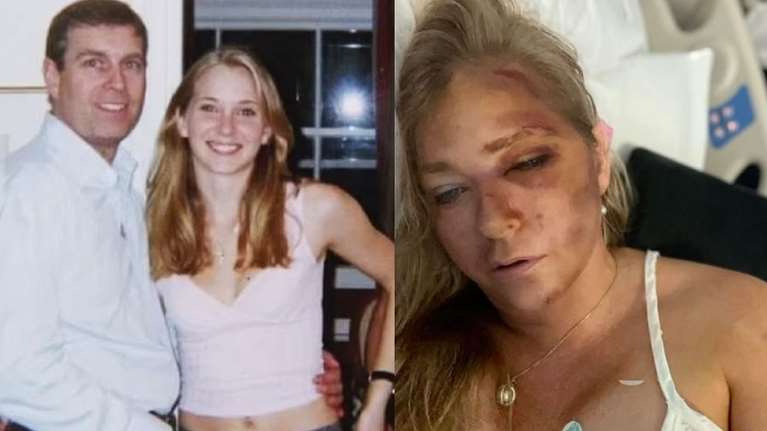 Περίεργο τροχαίο για τη γυναίκα που κατήγγειλε τον πρίγκιπα Άντριου και τον παιδόφιλο Έπσταϊν - &quot;Έχω 4 μέρες ζωής&quot;