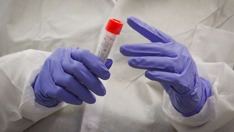 Αποκαλυπτική μελέτη: Ο κορονοϊός δεν φαίνεται να μεταδίδεται μέσω του ανδρικού σπέρματος