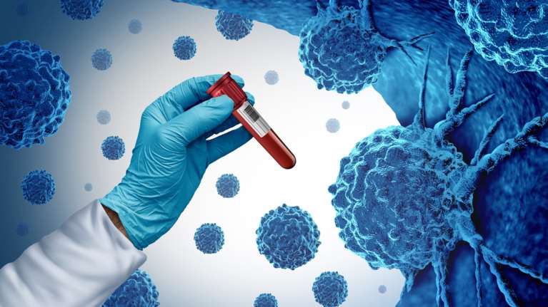 Το 40% των περιπτώσεων καρκίνου οφείλεται σε τροποποιήσιμους παράγοντες κινδύνου