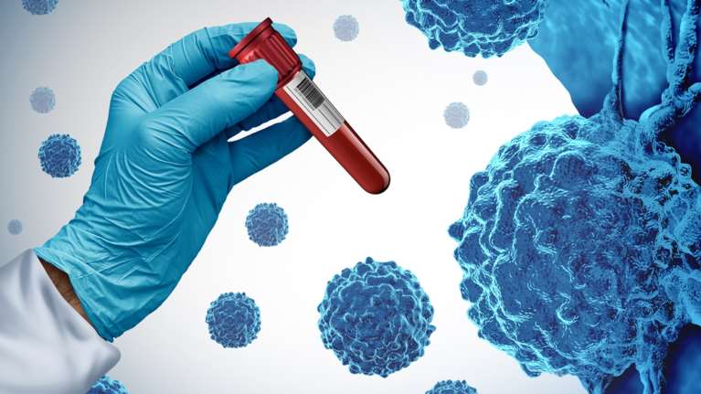 Economist: Οι επιστήμονες ανακαλύπτουν έναν νέο, ισχυρό τρόπο πρόληψης του καρκίνου