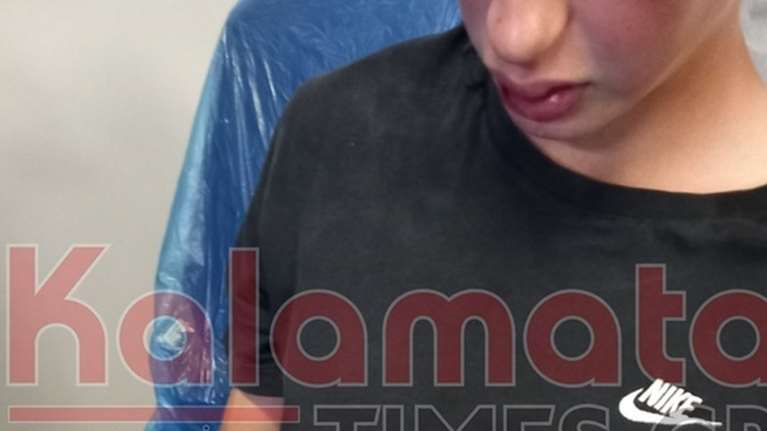 Καλαμάτα: Απίστευτος ξυλοδαρμός 16χρονου από συνομήλικούς του - Με βαριά τραύματα στο νοσοκομείο [εικόνες]