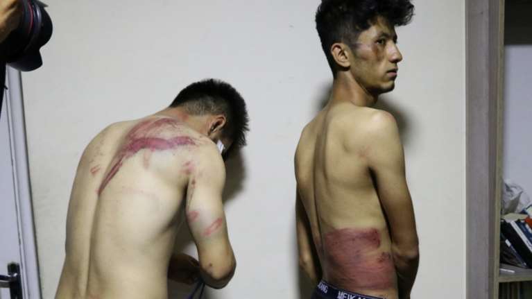 Αφγανιστάν: Ταλιμπάν βασάνισαν δύο δημοσιογράφους παρά τις υποσχέσεις για μη βία