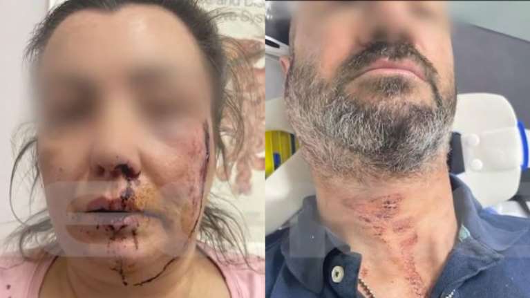 Αιγάλεω: Η περιγραφή του ζευγαριού που ξυλοκοπήθηκε στη Θηβών - "Έδωσε γκάζι και πάτησε το σώμα του άντρα μου"