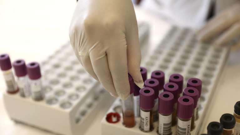 Κορονοϊός - Κοντοζαμάνης: Λύθηκε το πρόβλημα με τα τεστ στο Κέντρο Αιμοδοσίας