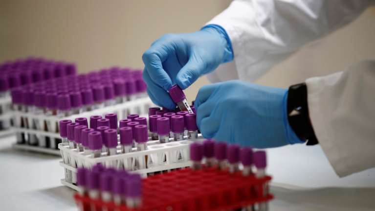 Κορονοϊός: Θετικά νέα για το &quot;κοκτέιλ&quot; αντισωμάτων κατά του Covid-19