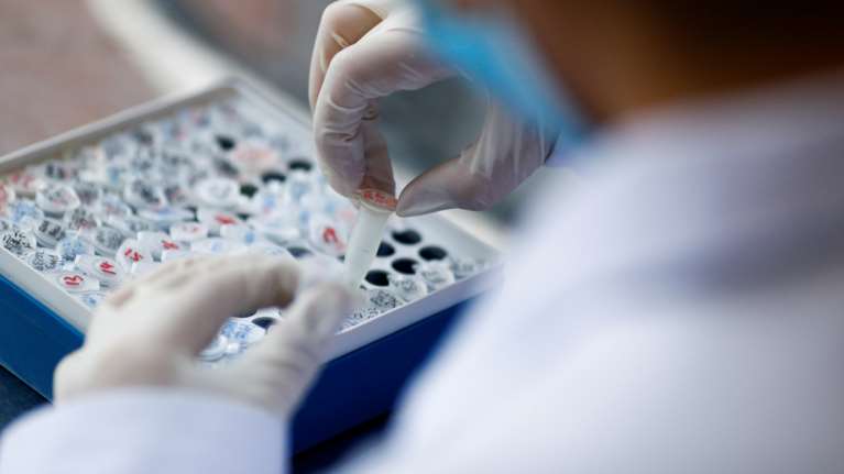 Κορονοϊός: Αυτοαντισώματα  μετά από ήπια λοίμωξη - Τι έδειξε μελέτη από το Cedars-Sinai