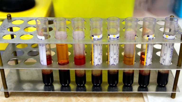 Γκάφα ολκής στη Ρόδο: Σμηνίτης μπήκε καραντίνα με λάθος δείγμα - Ψάχνουν να βρουν σε ποιον ανήκει