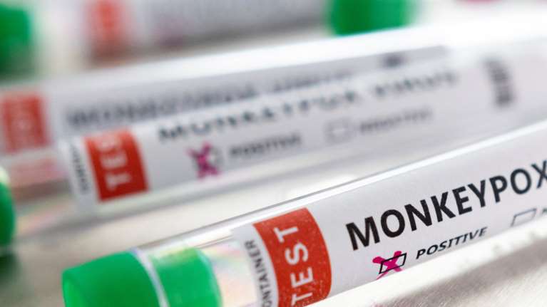 Ευλογιά των πιθήκων: 26χρονος που κόλλησε αφηγείται - &quot;Ηταν οι χειρότεροι πόνοι που έχω βιώσει ποτέ&quot;