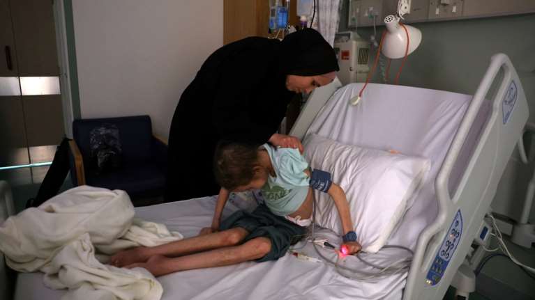 Ώρα μηδέν για τη Γάζα: Γροθιά στο στομάχι οι εικόνες σκελετωμένων παιδιών που πεθαίνουν από ασιτία [εικόνες - βίντεο]